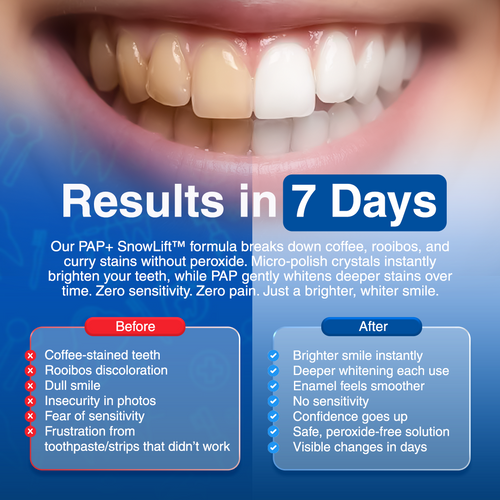 BRITE™ Peroxide-Free Whitening Powder – Zero Sensitivity, Instant Results