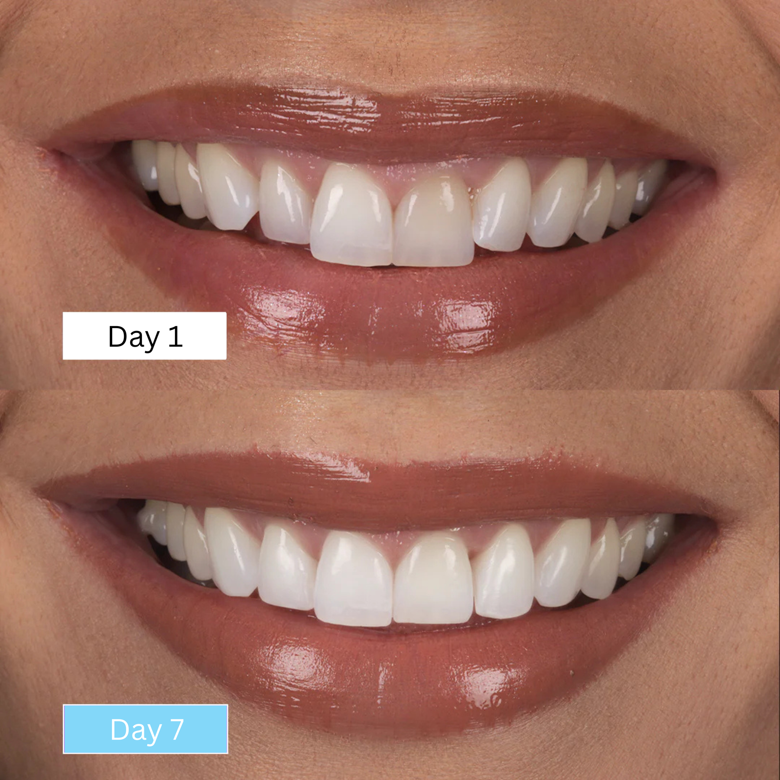 Get a Whiter Smile in Just 7 Days